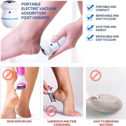 Electric Foot Callus Remover – Portable Foot Grinder & Vacuum Pedicure for Soft Feet & Cracked Heels