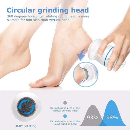 Electric Foot Callus Remover – Portable Foot Grinder & Vacuum Pedicure for Soft Feet & Cracked Heels