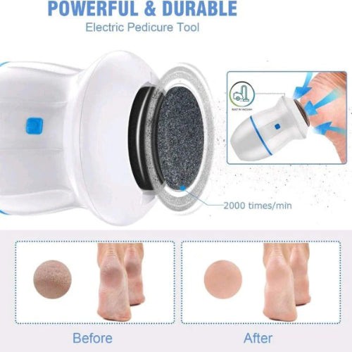 Electric Foot Callus Remover – Portable Foot Grinder & Vacuum Pedicure for Soft Feet & Cracked Heels