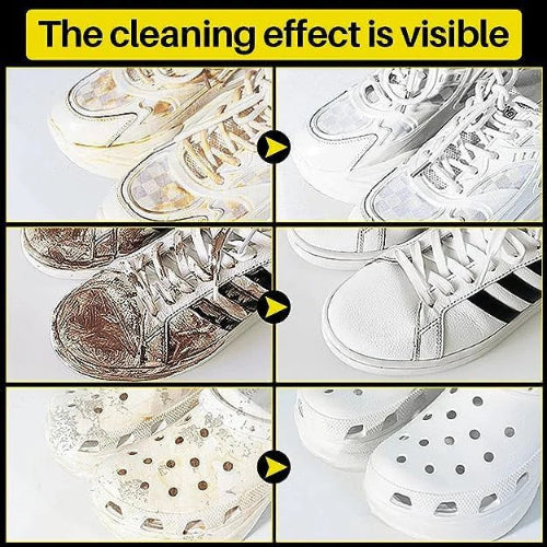 Premium Shoe Cleaner Wipes – Travel-Friendly Disposable Wipes for White Sneakers & Textured Shoes